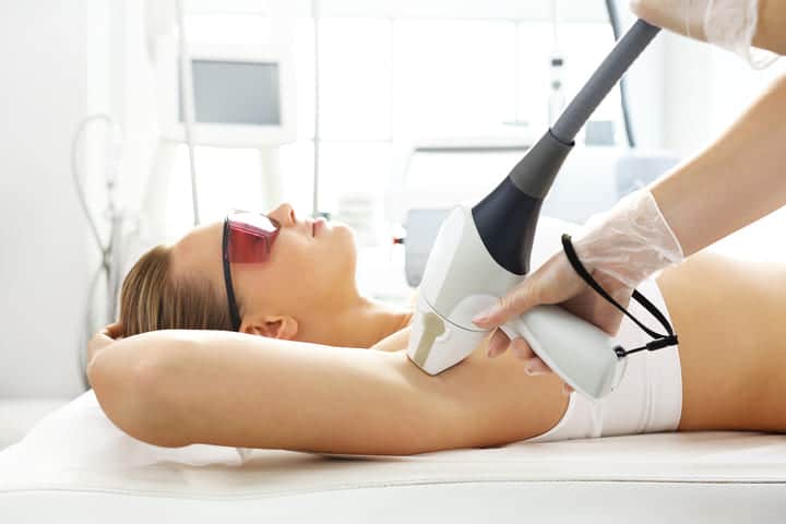 Épilation laser